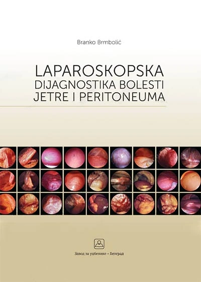 laparoskopska dijagnostika bolesti jetre i peritoneuma 