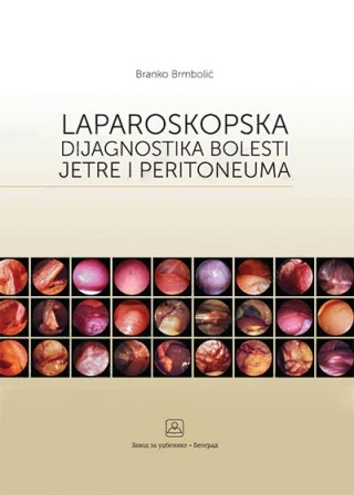 laparoskopska dijagnostika bolesti jetre i peritoneuma branko brmbolić 