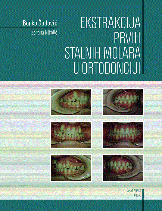Ekstrakcija prvih stalnih molara u ortodonciji