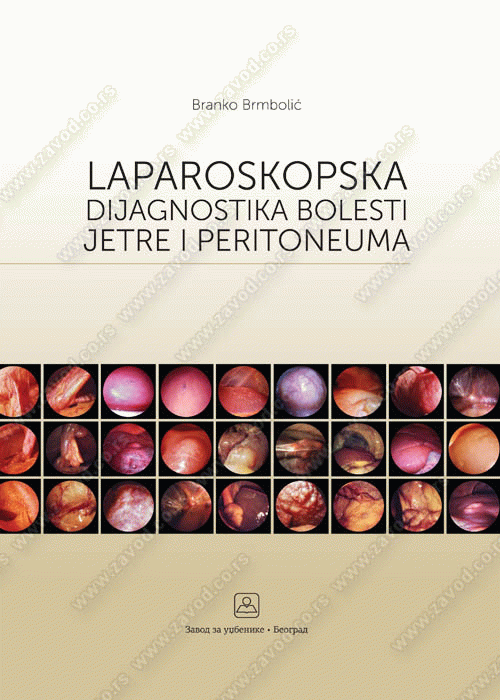 Laparoskopska dijagnostika bolesti jetre i peritoneuma